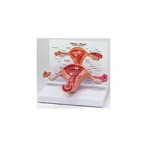  Basic Uterus/Ovary Model Industrial & Scientific