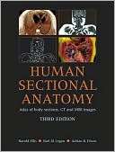 Human Sectional Anatomy Atlas Harold Ellis