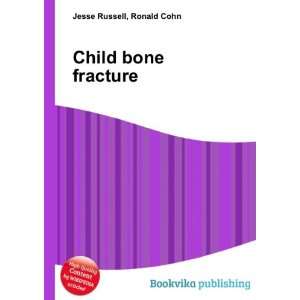  Child bone fracture Ronald Cohn Jesse Russell Books