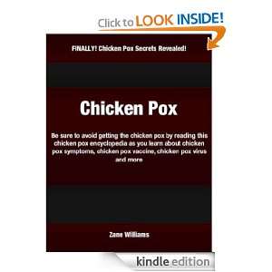   chicken pox symptoms, chicken pox vaccine, chicken pox virus and more