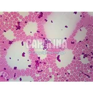 Bacteria, Yeast, and Blood, w.m., Microscope Slide  