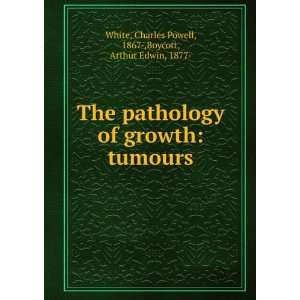 The pathology of growth tumours Charles Powell, 1867 ,Boycott 